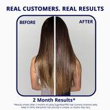 SugarBearHair Biotin Supplement lifestyle scene with healthy snacks