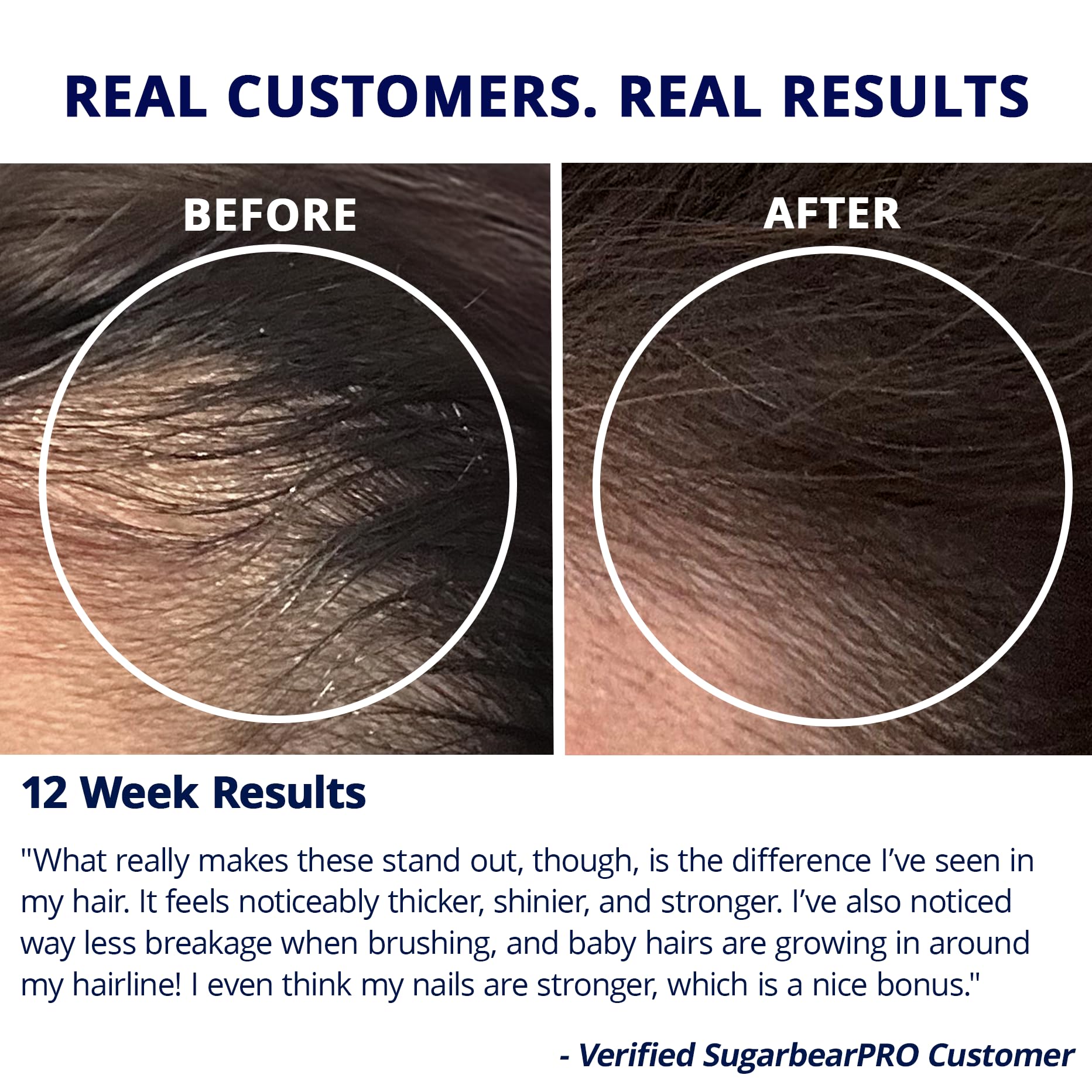 SugarBearHair Biotin Supplement with vitamins and minerals