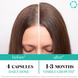 Superfood MD Nutra Women's Hair Growth Supplement capsules close-up