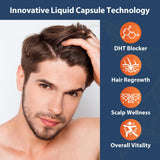 Talyvoriathor Saw Palmetto DHT Blocker Capsules liquid-filled capsule close-up