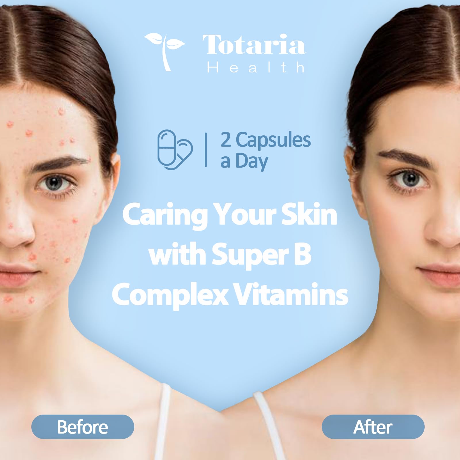 Totaria B-Complex 13-in-1 Vitamin Capsules opened bottle