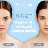 Totaria B-Complex 13-in-1 Vitamin Capsules opened bottle