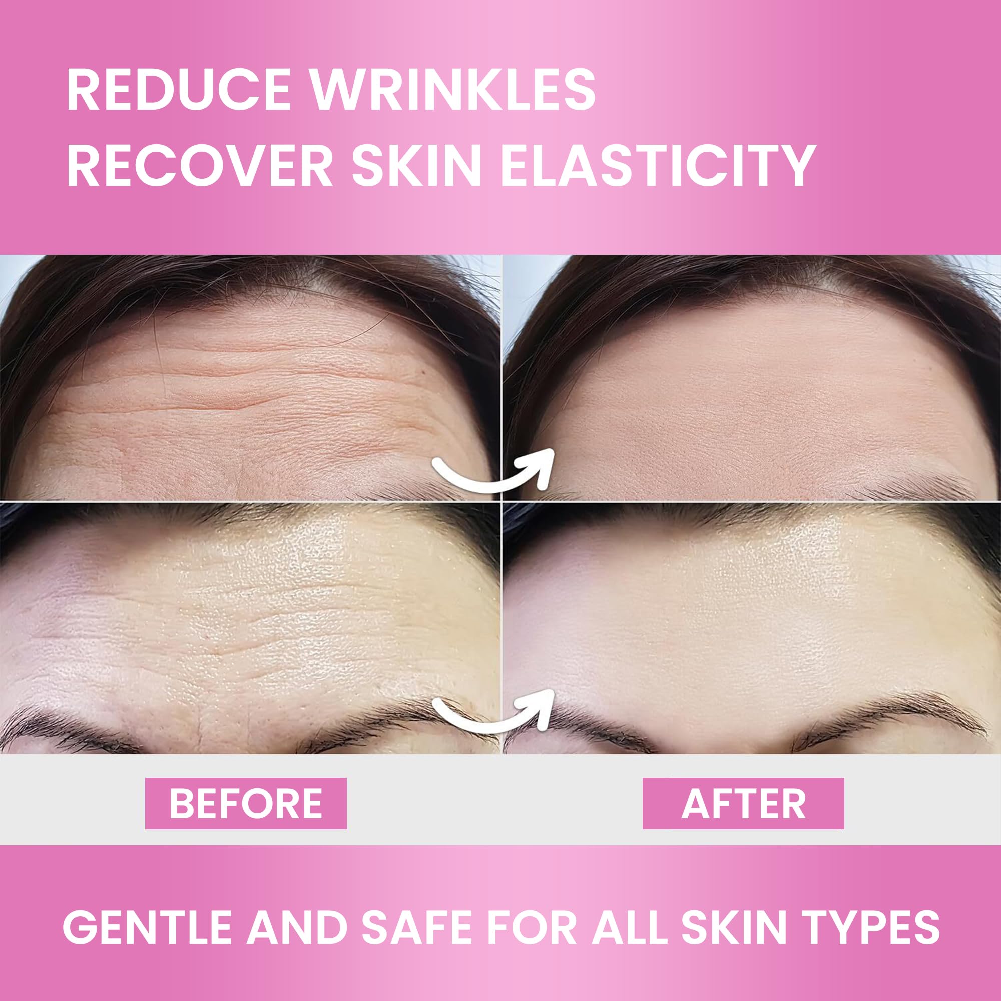 VIORY Forehead Wrinkle Patches in a bathroom setting