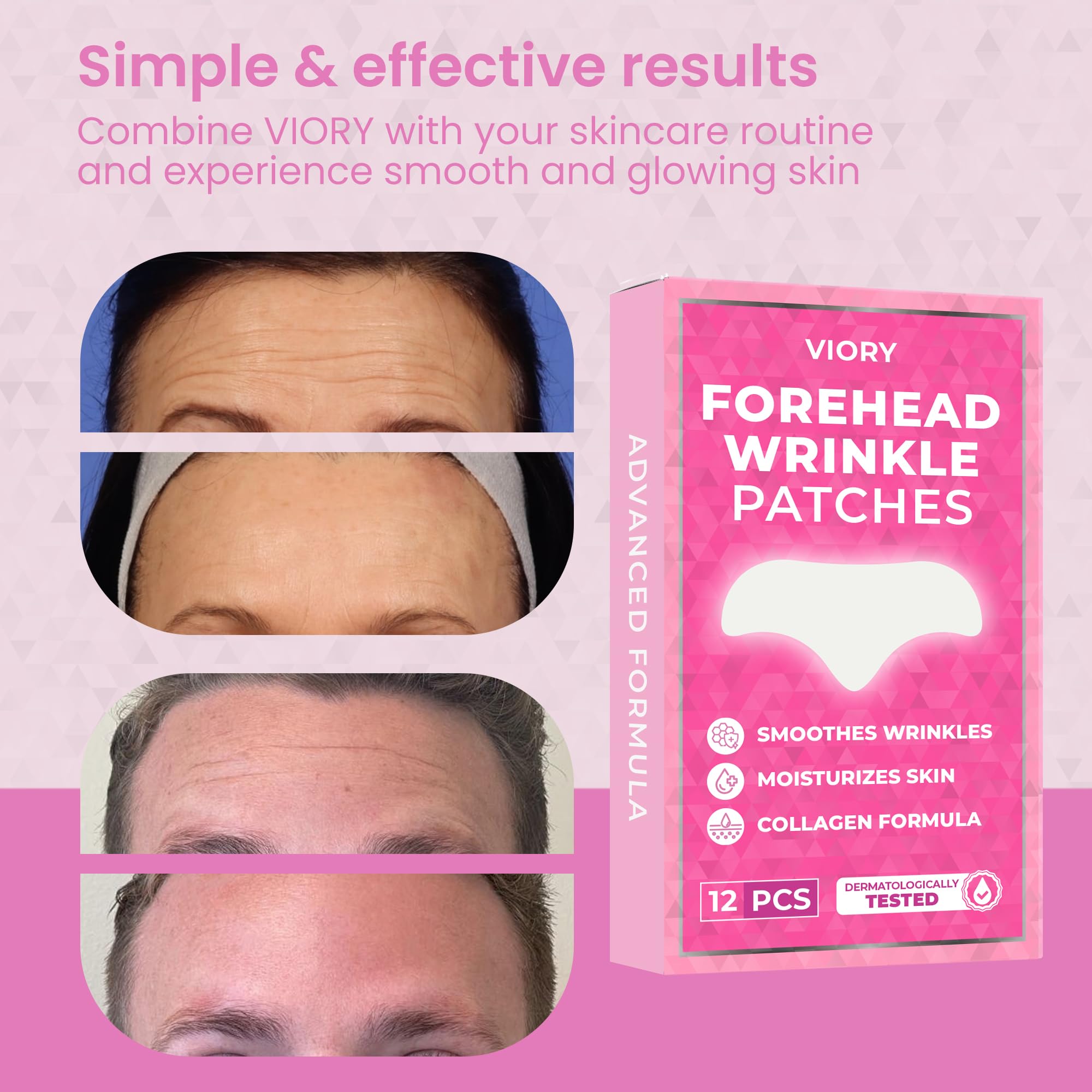 VIORY Forehead Wrinkle Patches in use on a model's forehead