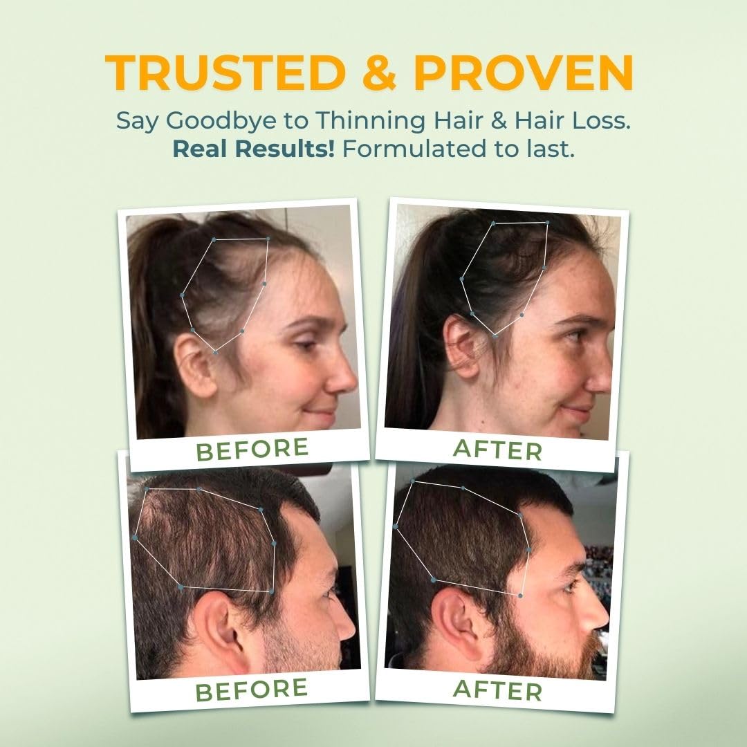 VITAL NUTRITIVE Vital Hair Complex packaging details