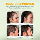 VITAL NUTRITIVE Vital Hair Complex packaging details