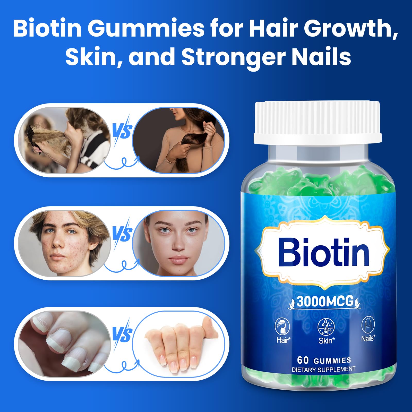 Vitaluxy Biotin Gummies with lifestyle background