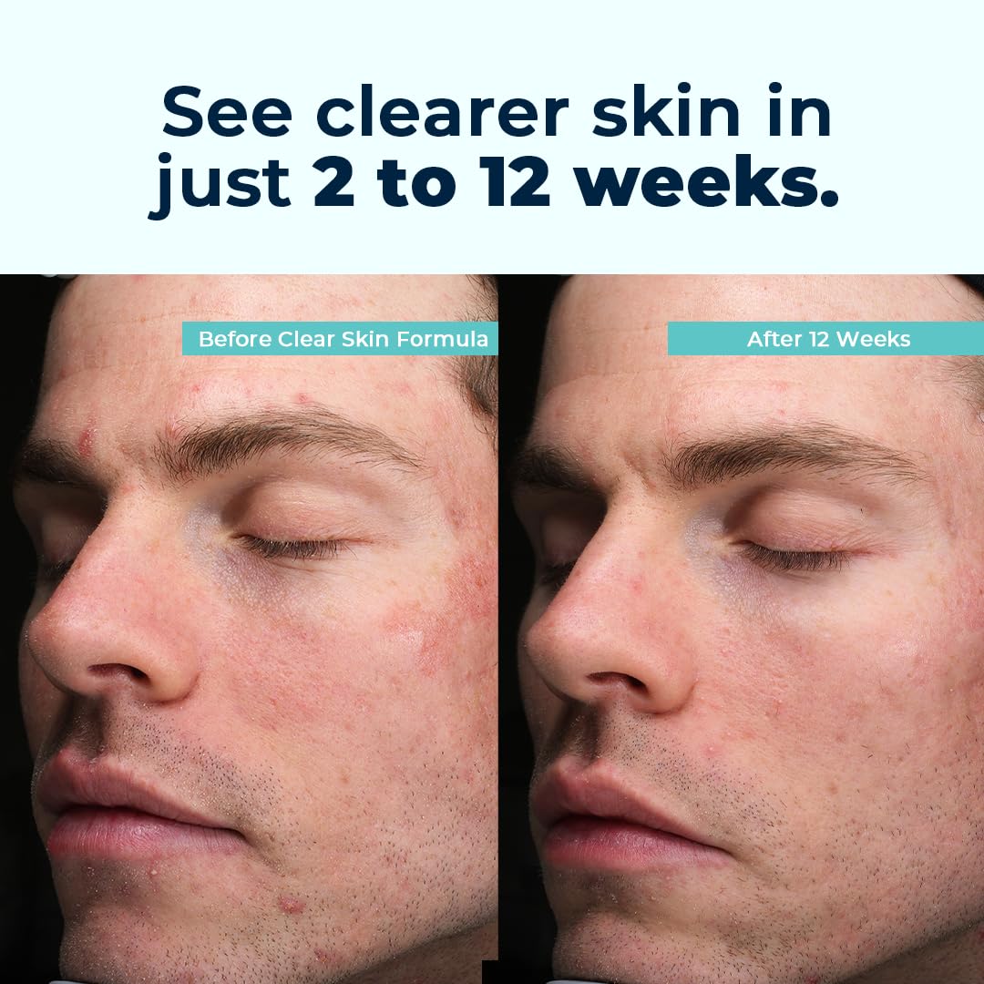 VitaMedica Clear Skin Formula 60g ingredients list on packaging
