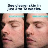 VitaMedica Clear Skin Formula 60g ingredients list on packaging