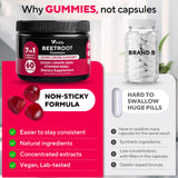 VitaUp Beet Root Gummies in a hand
