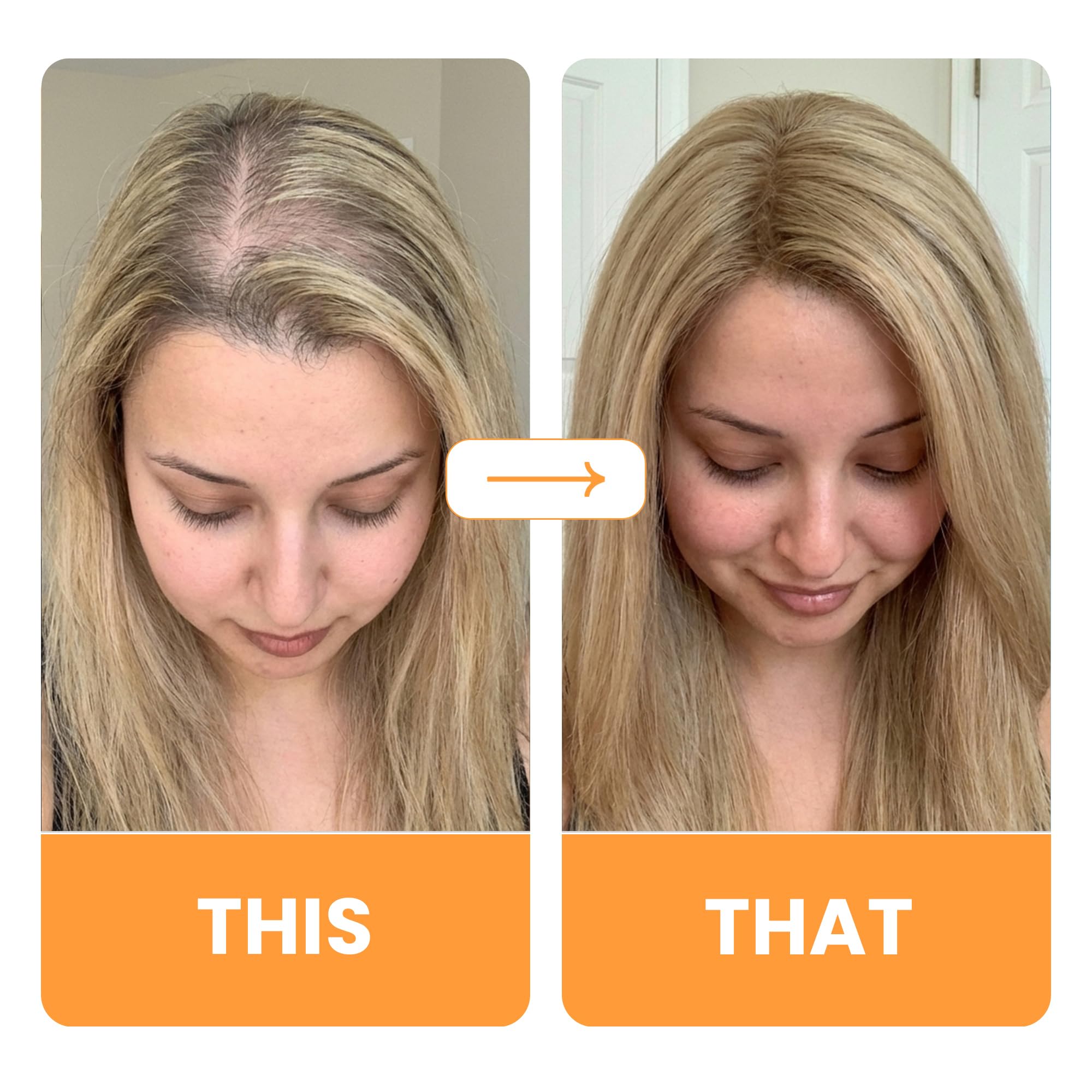 Vytadose Hair Growth Patches in lifestyle setting