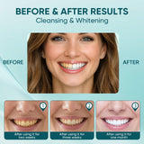WAESKI Velverdo Collagen Powder for Gums sprinkled on toothbrush