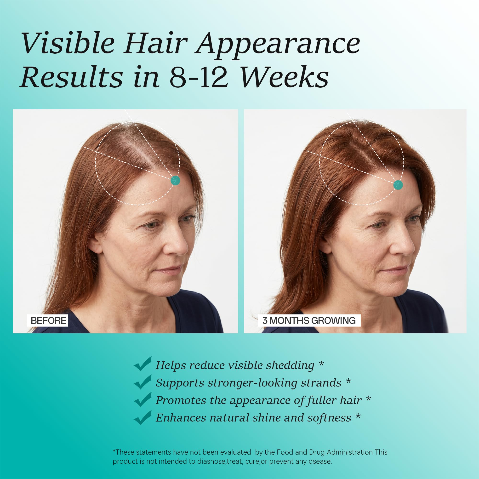 Wiltormin Hair Growth Supplement on a wooden table