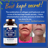 WINDSOR BOTANICALS Collagen Complex showing capsule size