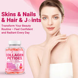 Wiszeen Collagen Gummies for Women in a hand for size perspective