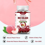 Zammex Multi-Collagen Gummies in a lifestyle setting